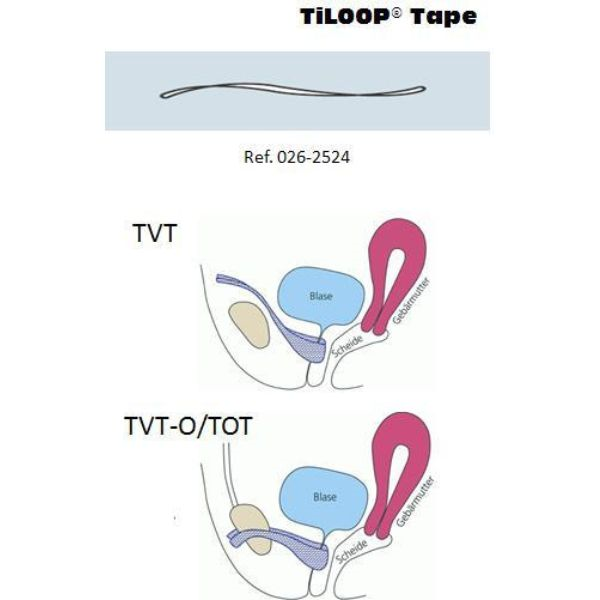Malla Titanizada Tiloop Tape TVT-TVTO 35 gr